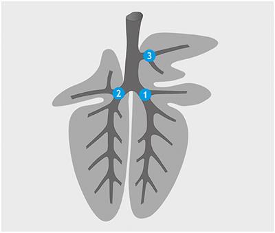 Video Endoscopy-Guided Intrabronchial Spray Inoculation of Mycobacterium bovis in Goats and Comparative Assessment of Lung Lesions With Various Imaging Methods